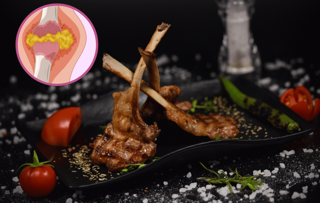 Can You Eat Turkey With Gout: What Foods To Avoid